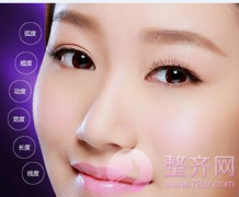 你适合做双眼皮手术吗？